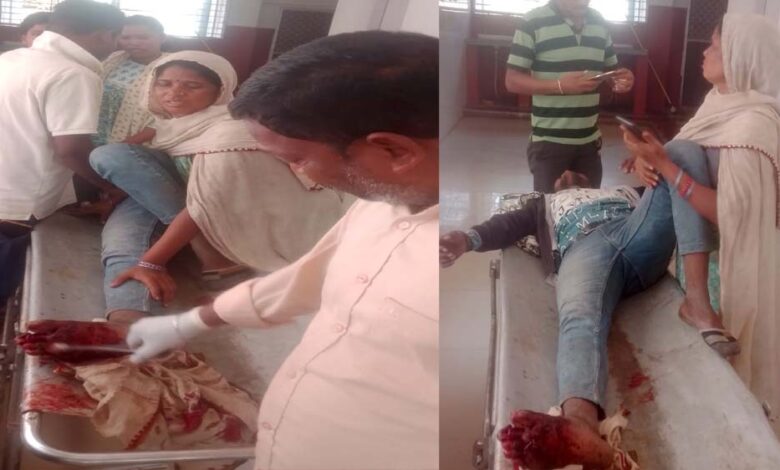 ऑटो और बाइक की भिंडत, बाइक चालक को आया गंभीर चोटें पैर की दो उंगली टूटने की आशंका 1 17A 33