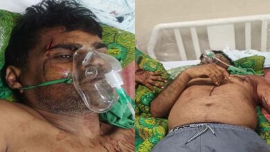 कुल्हाड़ी से हमला: गाली-गलौज का विरोध करने पर पूर्व जनपद सदस्य प्रतिनिधि पर जानलेवा वार 7 7A 43