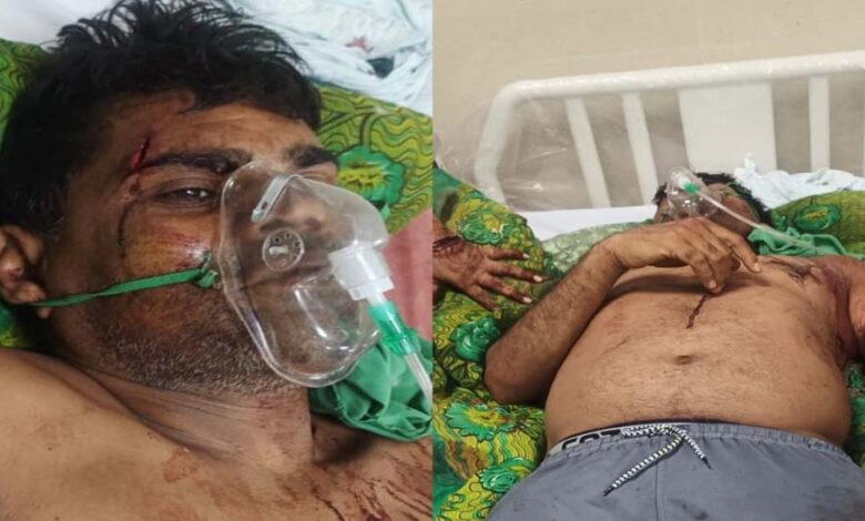 कुल्हाड़ी से हमला: गाली-गलौज का विरोध करने पर पूर्व जनपद सदस्य प्रतिनिधि पर जानलेवा वार 1 7A 43